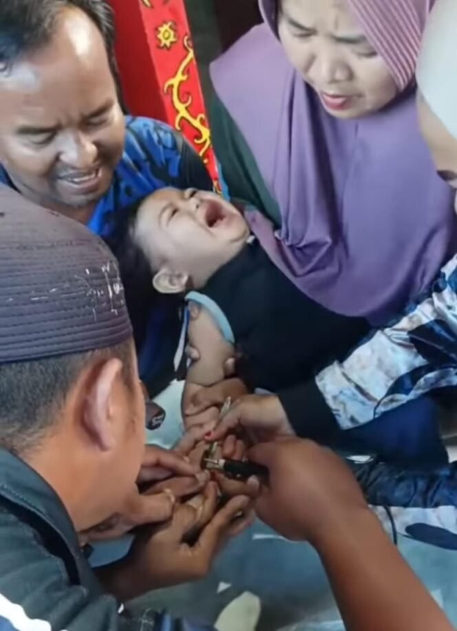 
					Tangis bayi Syawal (2), saat petugas Damkar berusaha memotong cincin besi yang membuat jari manisnya bengkak.