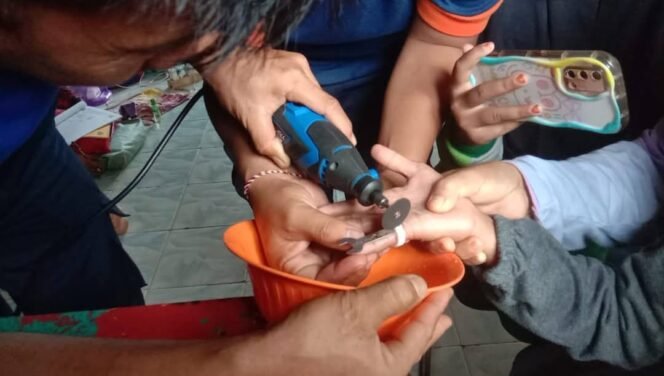 
					Aksi petugas Damkar Nunukan mengeluarkan plastik berbentuk cincin dari jari Nurul (12) murid MI Raudhotut Tarbiyah, Jumat (11/4/2024) - Dok.Disdamkar Nunukan.